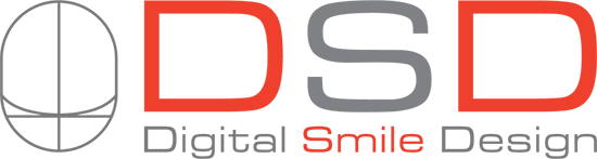 DSD – Digital Smile Design